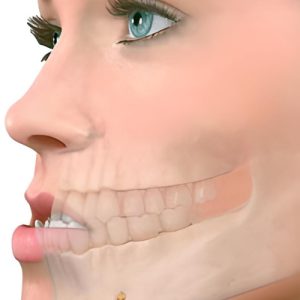 Chirurgie Maxillo Faciale